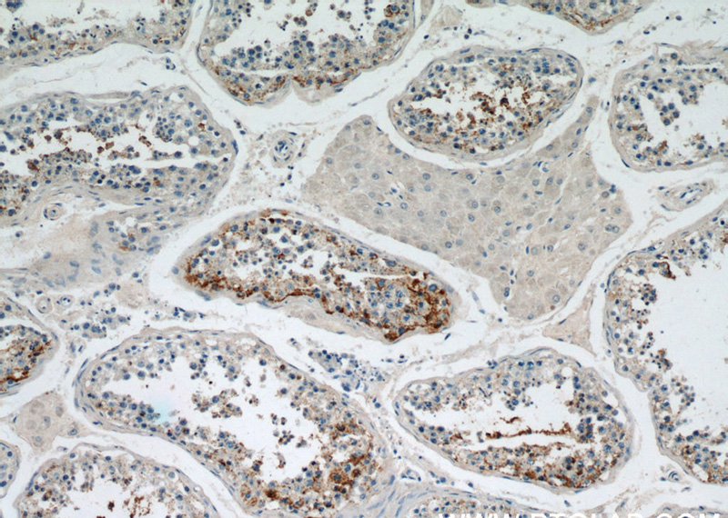 Immunohistochemical of paraffin-embedded human testis using Catalog No:115640(SPPL2A antibody) at dilution of 1:50 (under 10x lens)