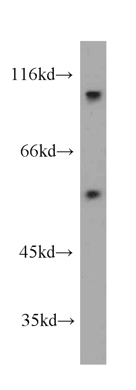 SKOV-3 cells were subjected to SDS PAGE followed by western blot with Catalog No:107421(MCRS1 antibody) at dilution of 1:1000