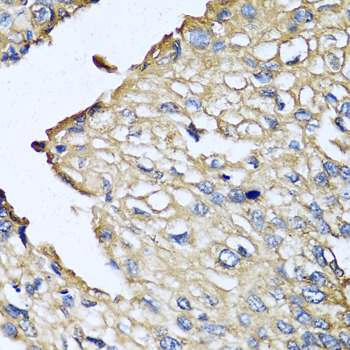 Immunohistochemistry - ASIP Polyclonal Antibody 