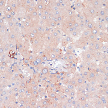 Immunohistochemistry - ZNRF3 Polyclonal Antibody 