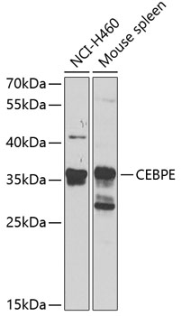 Western blot - CEBPE Polyclonal Antibody 
