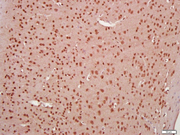 Fig3: Paraformaldehyde-fixed, paraffin embedded (Mouse brain); Antigen retrieval by boiling in sodium citrate buffer (pH6.0) for 15min; Block endogenous peroxidase by 3% hydrogen peroxide for 20 minutes; Blocking buffer (normal goat serum) at 37℃ for 30min; Antibody incubation with (KLHL24) Polyclonal Antibody, Unconjugated at 1:400 overnight at 4℃, followed by a conjugated secondary (sp-0023) for 20 minutes and DAB staining.