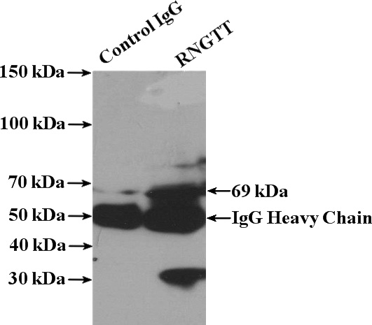 IP Result of anti-RNGTT (IP:Catalog No:114766, 4ug; Detection:Catalog No:114766 1:500) with mouse kidney tissue lysate 4000ug.