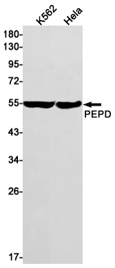Western blot detection of PEPD in K562,Hela cell lysates using PEPD Rabbit mAb(1:1000 diluted).Predicted band size:55kDa.Observed band size:55kDa.