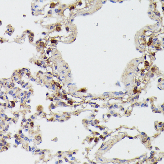 Immunohistochemistry - RIPK1 Polyclonal Antibody 