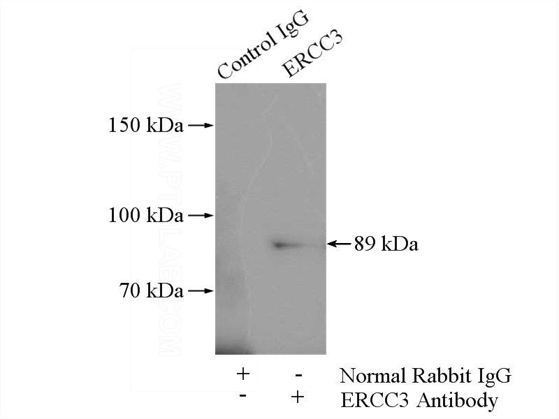 IP Result of anti-ERCC3 (IP:Catalog No:110409, 4ug; Detection:Catalog No:110409 1:500) with A431 cells lysate 1200ug.