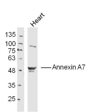 Fig1: Sample:; Heart (Mouse) Lysate at 40 ug; Primary: Anti- Annexin A7 at 1/300 dilution; Secondary: IRDye800CW Goat Anti-Rabbit IgG at 1/20000 dilution; Predicted band size: 54 kD; Observed band size: 54 kD