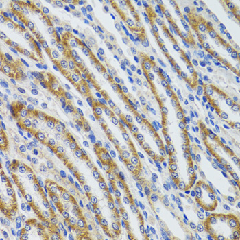 Immunohistochemistry - HEXA Polyclonal Antibody 