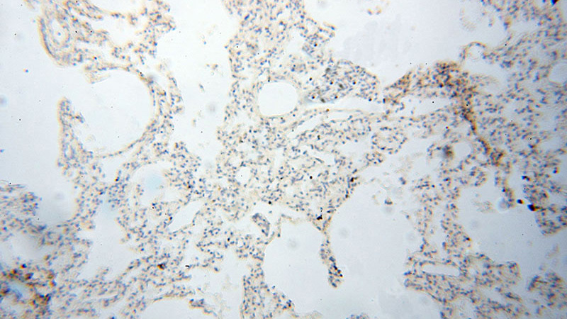 Immunohistochemical of paraffin-embedded human lung using Catalog No:112278(LAMP3 antibody) at dilution of 1:50 (under 10x lens)