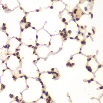 Immunohistochemistry - UHRF2 Polyclonal Antibody 