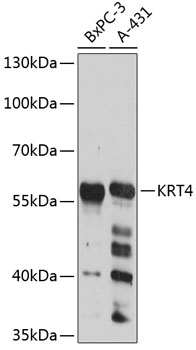 Western blot - KRT4 Polyclonal Antibody 