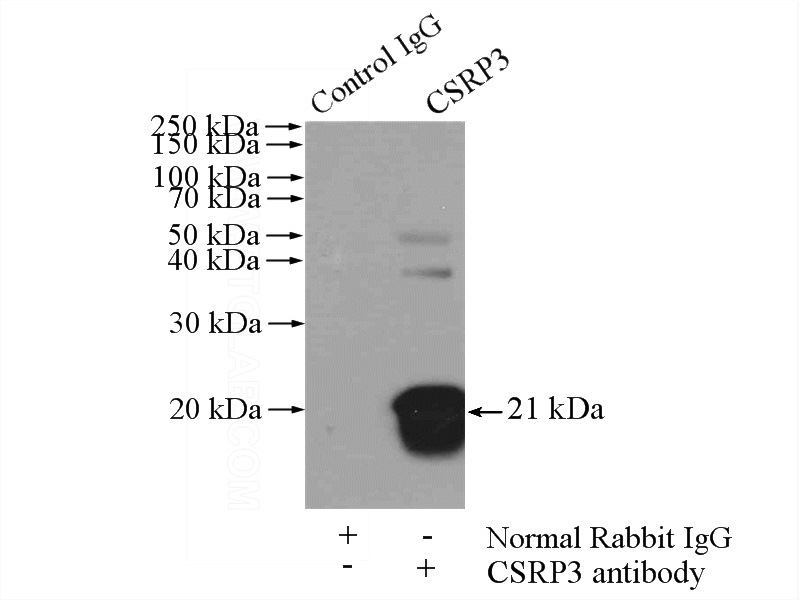 IP Result of anti-CSRP3 (IP:Catalog No:109610, 4ug; Detection:Catalog No:109610 1:2000) with mouse heart tissue lysate 4000ug.