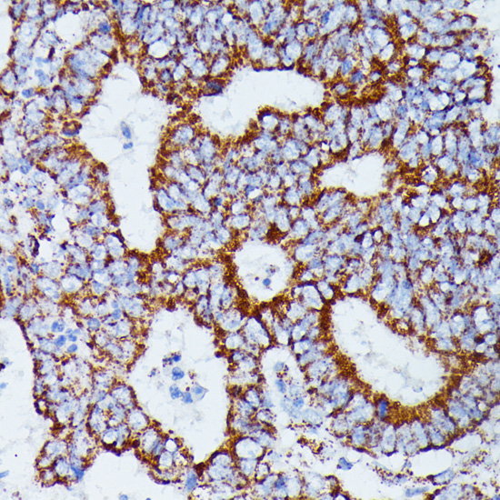 Immunohistochemistry - IDH3A Polyclonal Antibody 