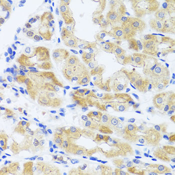 Immunohistochemistry - INADL Polyclonal Antibody 