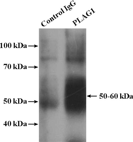 IP Result of anti-PLAG1 (IP:Catalog No:113935, 4ug; Detection:Catalog No:113935 1:300) with HepG2 cells lysate 2400ug.