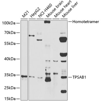 Western blot - TPSAB1 Polyclonal Antibody 