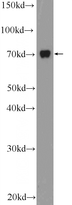 HepG2 cells were subjected to SDS PAGE followed by western blot with Catalog No:115965(MAP3K7IP2 Antibody) at dilution of 1:600