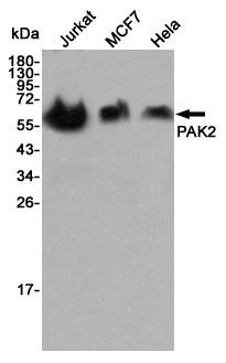 Western blot detection of PAK2 in Jurkat,MCF7 and Hela cell lysates using PAK2 mouse mAb (1:5000 diluted).Predicted band size:61KDa.Observed band size:61KDa.