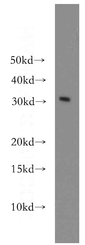 mouse lung tissue were subjected to SDS PAGE followed by western blot with Catalog No:115187(SH3BGRL3 antibody) at dilution of 1:100