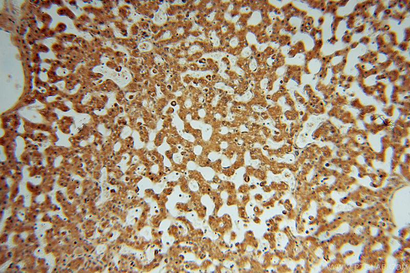 Immunohistochemical of paraffin-embedded human liver using Catalog No:112198(LEPREL1 antibody) at dilution of 1:50 (under 10x lens)