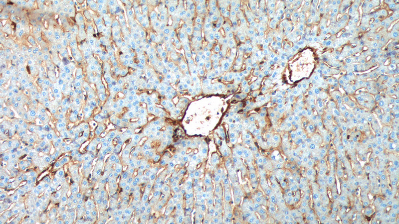Immunohistochemistry of paraffin-embedded human liver tissue slide using Catalog No:108093(Annexin A2 Antibody) at dilution of 1:200 (under 10x lens).