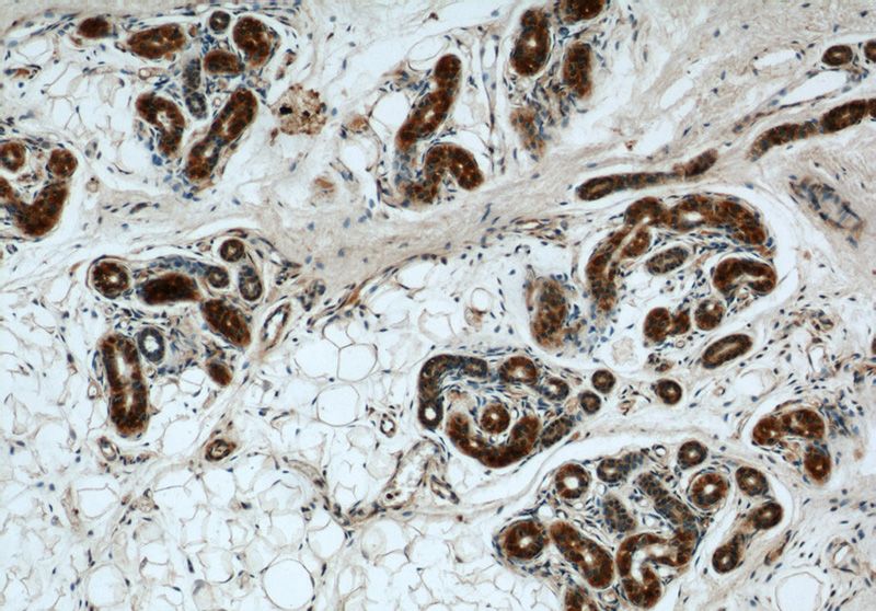 Immunohistochemical of paraffin-embedded human skin using Catalog No:108383(BCAT2 antibody) at dilution of 1:50 (under 10x lens)