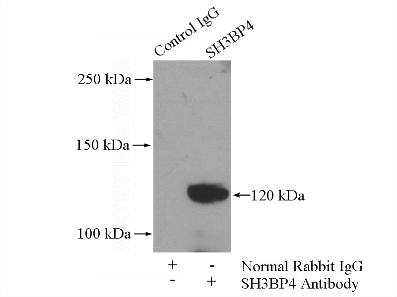 IP Result of anti-SH3BP4 (IP:Catalog No:115189, 4ug; Detection:Catalog No:115189 1:300) with mouse lung tissue lysate 3600ug.