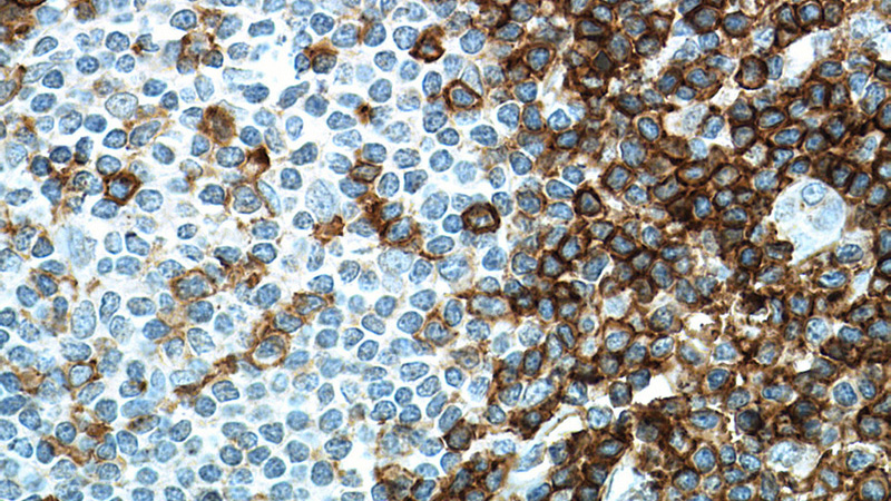 Immunohistochemistry of paraffin-embedded human tonsillitis tissue slide using (SPN Antibody) at dilution of 1:100 (under 40x lens). . Heat mediated antigen retrieved with Tris-EDTA buffer, pH9.0