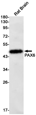 Western blot detection of PAX6 in Rat Brain lysates using PAX6 Rabbit mAb(1:1000 diluted).Predicted band size:47kDa.Observed band size:47kDa.