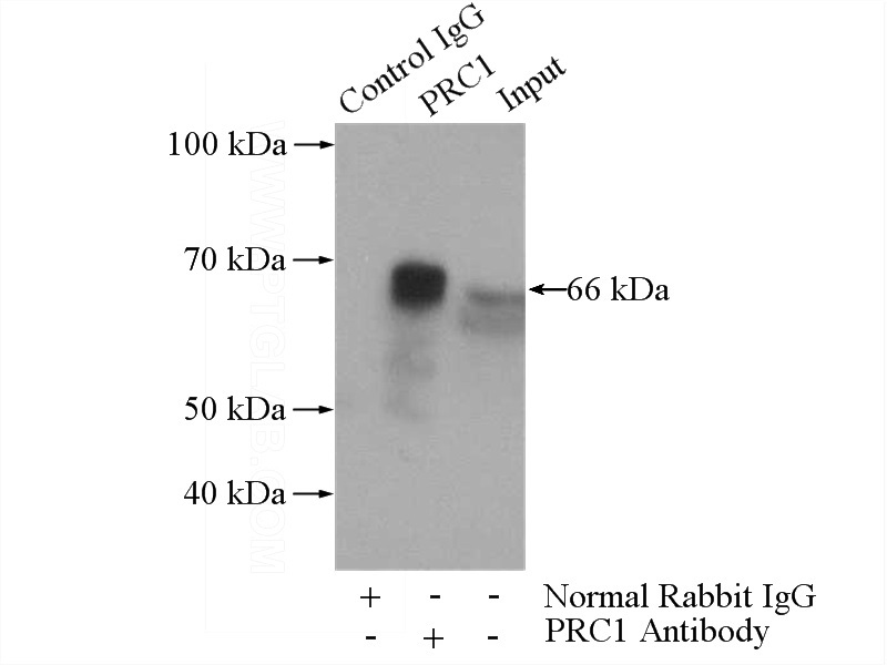 IP Result of anti-PRC1 (IP:Catalog No:114169, 4ug; Detection:Catalog No:114169 1:300) with HEK-293 cells lysate 1480ug.
