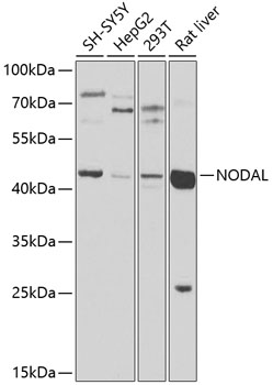Western blot - NODAL Polyclonal Antibody 