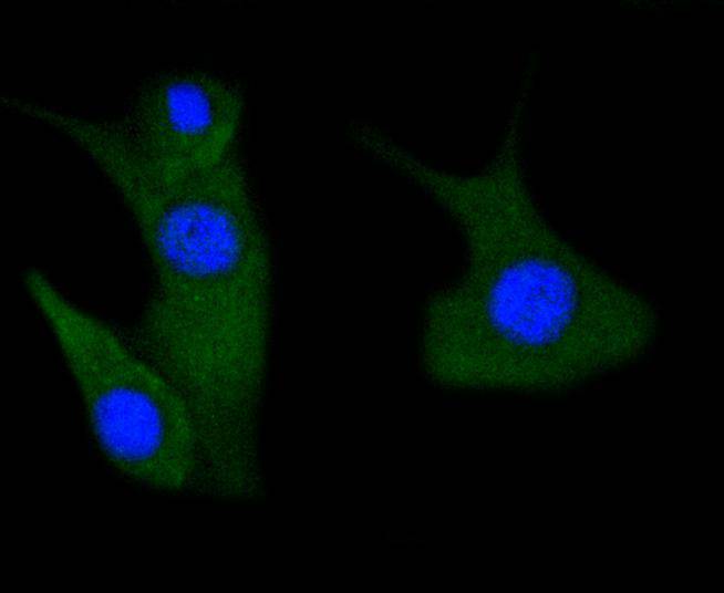 Fig3:; ICC staining of Phospho-PAK1(S144)+PAK2(S141)+PAK3(S139) in NIH/3T3 cells (green). Formalin fixed cells were permeabilized with 0.1% Triton X-100 in TBS for 10 minutes at room temperature and blocked with 1% Blocker BSA for 15 minutes at room temperature. Cells were probed with the primary antibody ( 1/50) for 1 hour at room temperature, washed with PBS. Alexa Fluor®488 Goat anti-Rabbit IgG was used as the secondary antibody at 1/1,000 dilution. The nuclear counter stain is DAPI (blue).