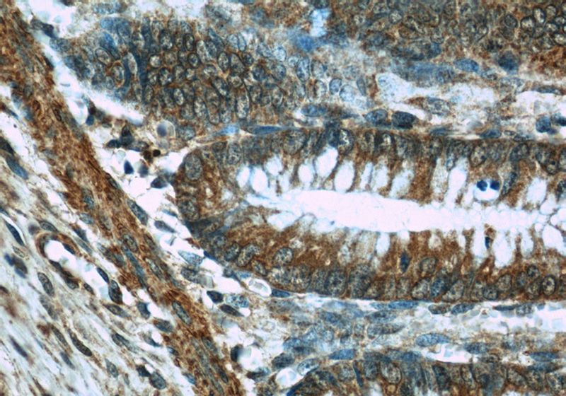 Immunohistochemistry of paraffin-embedded human colon slide using Catalog No:113300(NOMO1 Antibody) at dilution of 1:50