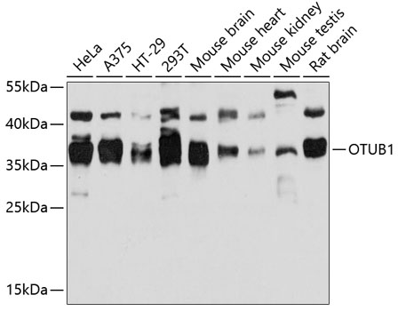 Western blot - OTUB1 Polyclonal Antibody 