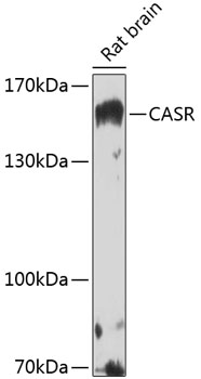 Western blot - CASR Polyclonal Antibody 