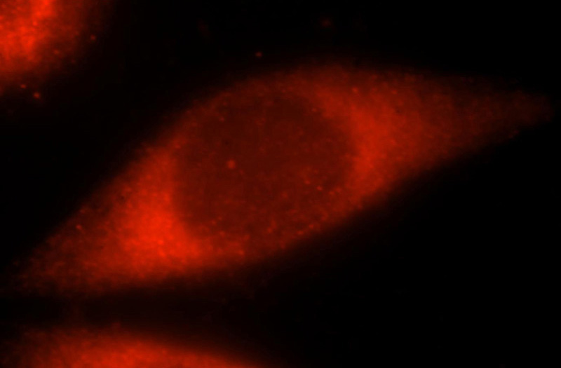 Immunofluorescent analysis of Hela cells, using RIBC2 antibody Catalog No:114695 at 1:25 dilution and Rhodamine-labeled goat anti-rabbit IgG (red).