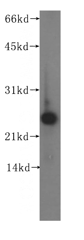 human liver tissue were subjected to SDS PAGE followed by western blot with Catalog No:109311(CIB1 antibody) at dilution of 1:400