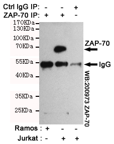 Immunoprecipitation analysis of Jurkat cell lysates (ZAP-70 positive expression cell line)and Ramos cell lysates(ZAP-70 negative expression cell line) using ZAP-70 mouse mAb.