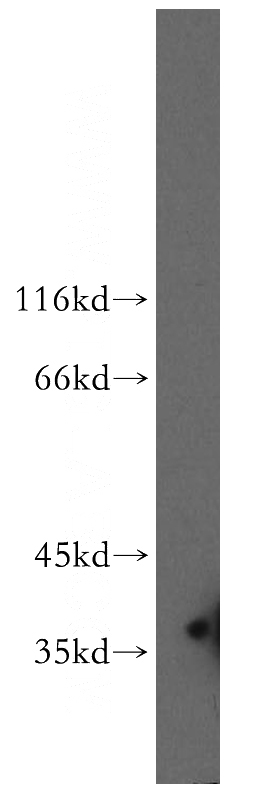 human testis tissue were subjected to SDS PAGE followed by western blot with Catalog No:110679(FKBP6 antibody) at dilution of 1:600
