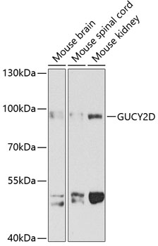 Western blot - GUCY2D Polyclonal Antibody 
