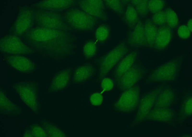Immunofluorescent analysis of (10% Formaldehyde) fixed HeLa cells using Catalog No:114377(PSMA7 Antibody) at dilution of 1:50 and Alexa Fluor 488-congugated AffiniPure Goat Anti-Rabbit IgG(H+L)