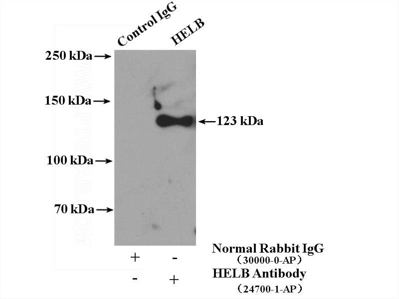 IP Result of anti-HELB (IP:Catalog No:111399, 4ug; Detection:Catalog No:111399 1:1000) with HEK-293 cells lysate 3000ug.