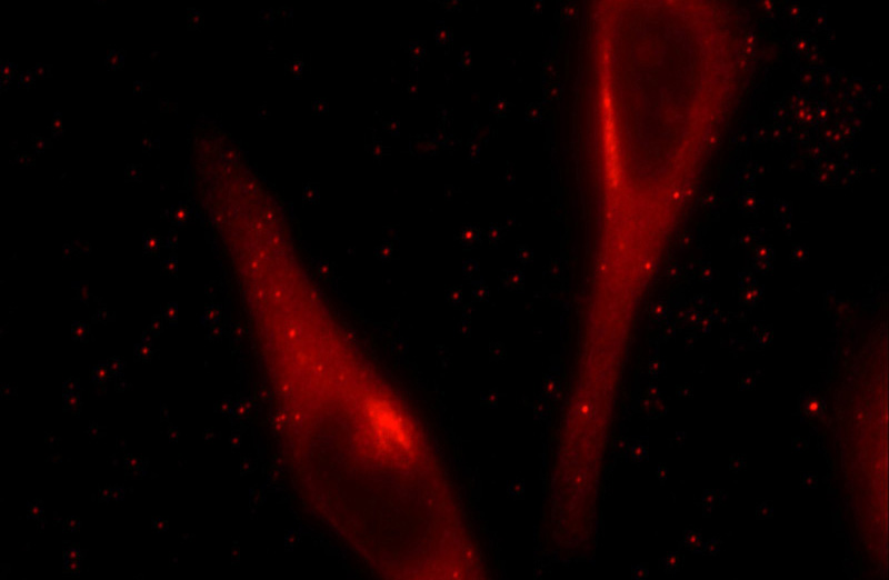 Immunofluorescent analysis of HeLa cells using Catalog No:111196(GRASP65,GORASP1 Antibody) at dilution of 1:25 and Rhodamine-Goat anti-Rabbit IgG
