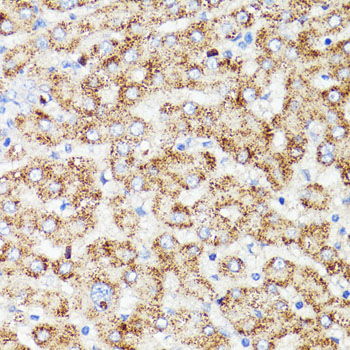 Immunohistochemistry - PRR11 Polyclonal Antibody 