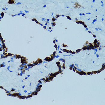 Immunohistochemistry - CTSE Polyclonal Antibody 