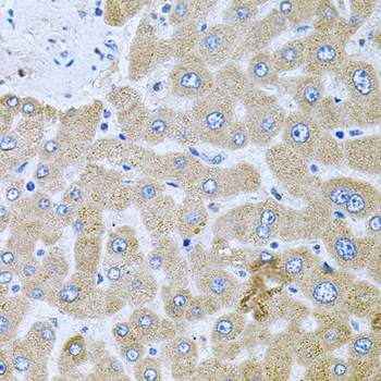 Immunohistochemistry - POMGNT1 Polyclonal Antibody 