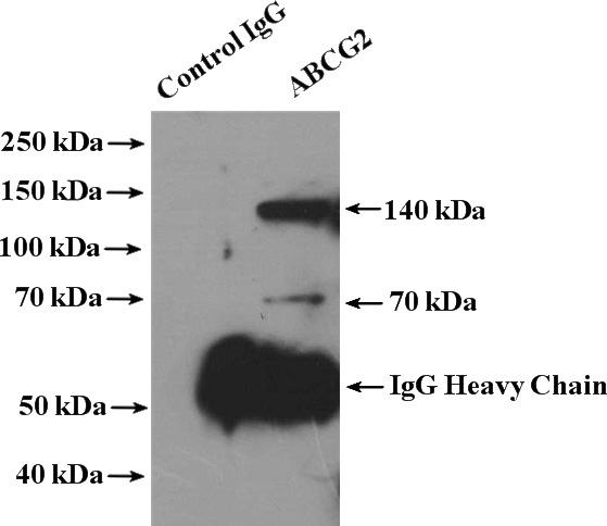 IP Result of anti-BCRP,ABCG2 (IP:Catalog No:107082, 4ug; Detection:Catalog No:107082 1:1000) with NCCIT cell lysate 2000ug.