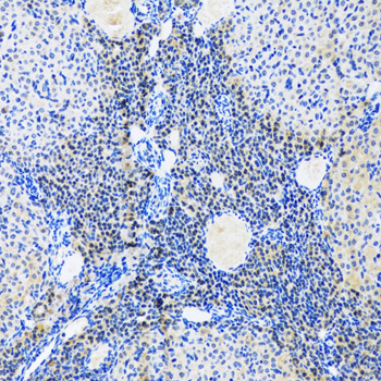 Immunohistochemistry - Myogenin Polyclonal Antibody 