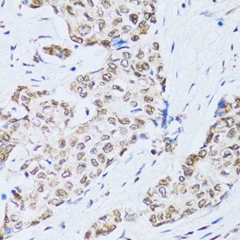 Immunohistochemistry - MTA3 Polyclonal Antibody 
