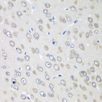 Immunohistochemistry - RPN2 Polyclonal Antibody 